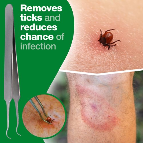 Tick Remover 11.3cm